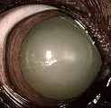eye2