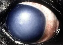eye3